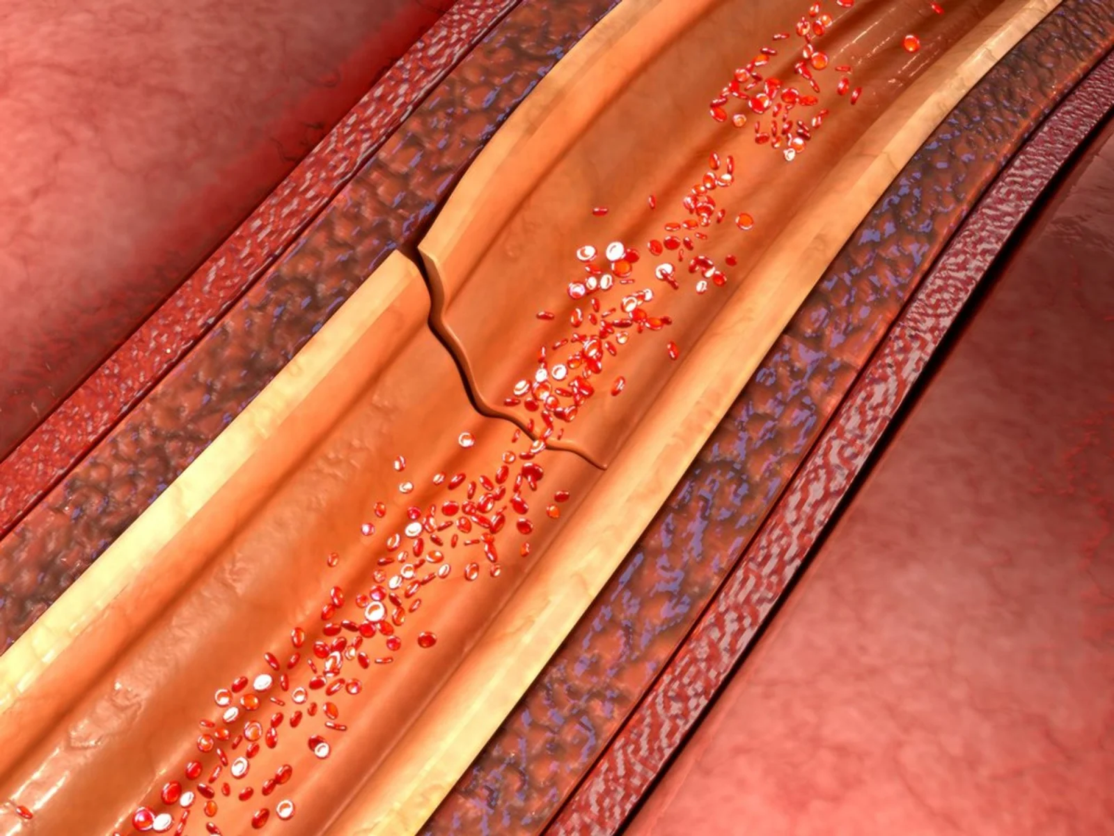 Illustration of blood flow in artery.